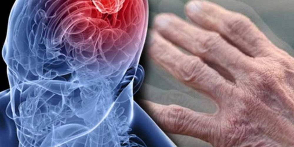 Является ли болезнь Паркинсона аутоиммунным заболеванием