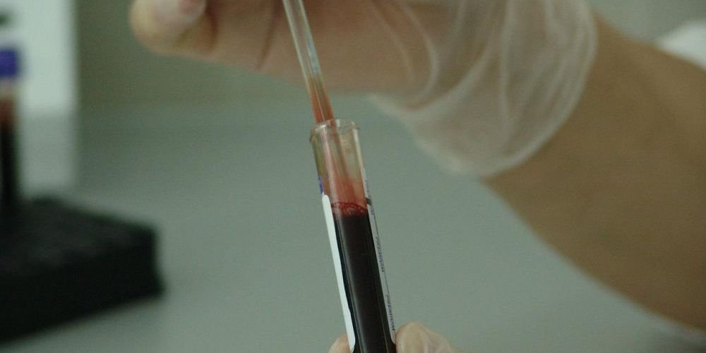 ДНК-тест позволит предотвратить сотни тысяч инсультов