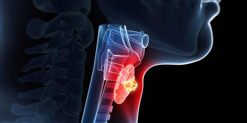 Питание для профилактики и лечения болезней щитовидной железы