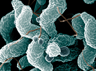 Определенные сексуальные практики грозят заражением опасной бактерией