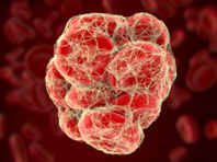 Российские медики узнали, кому из жертв COVID-19 грозит тромбоз