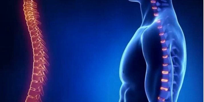Осевший позвоночник: причина болезней и старения организма