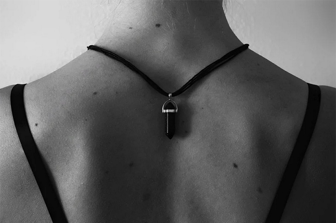 Врачи назвали признаки опасных родинок