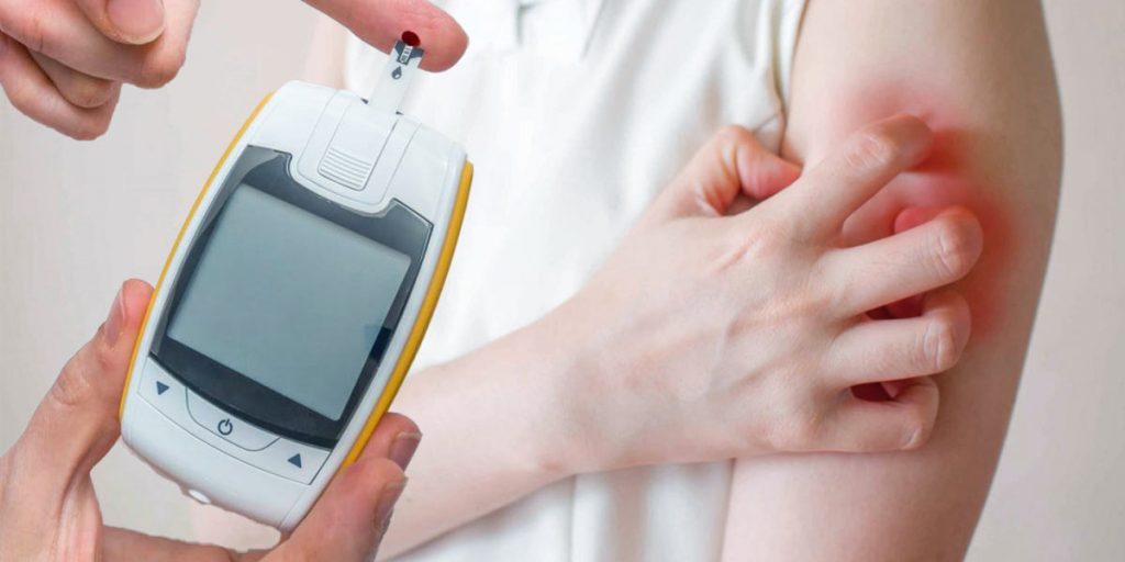 Терапевт перечислила признаки повышенного сахара в крови