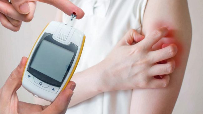 Терапевт перечислила признаки повышенного сахара в крови