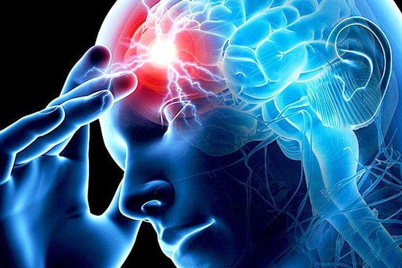3 первых признака инсульта: запомните, чтобы спасти жизнь