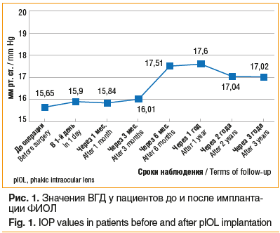 Рис. 1. Значения ВГД у пациентов до и после имплантации ФИОЛ Fig. 1. IOP values in patients before and after pIOL implantation