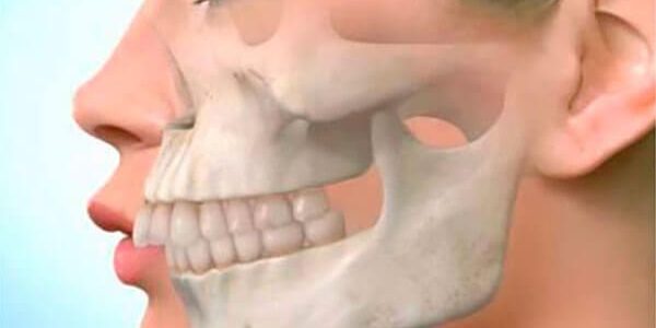 «Птичий профиль» и другие дефекты, которые исправит только стоматолог