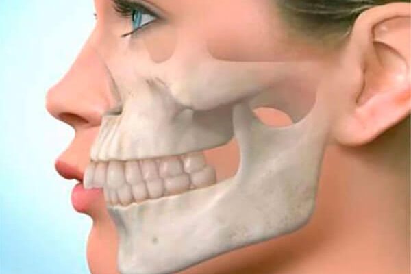 «Птичий профиль» и другие дефекты, которые исправит только стоматолог