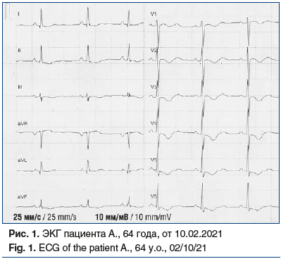Рис. 1. ЭКГ пациента А., 64 года, от 10.02.2021 Fig. 1. ECG of the patient A., 64 y.o., 02/10/21