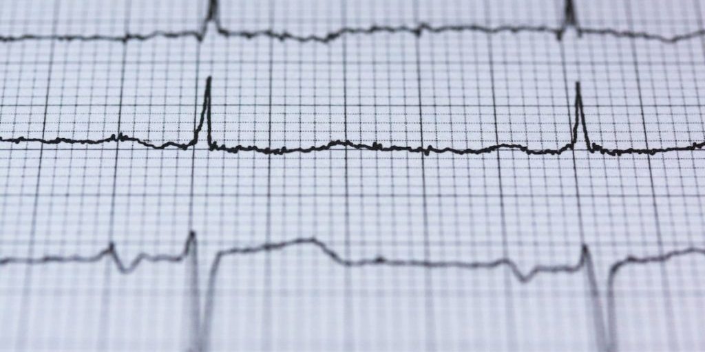 80% людей сообщают об одних и тех же 5 симптомах за месяц до сердечного приступа