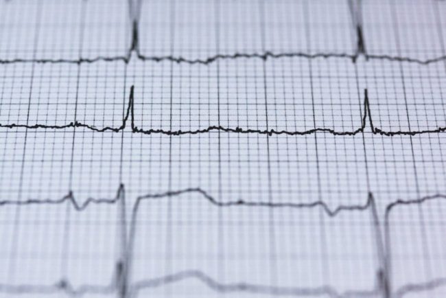 80% людей сообщают об одних и тех же 5 симптомах за месяц до сердечного приступа