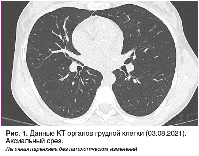 Рис. 1. Данные КТ органов грудной клетки (03.08.2021). Аксиальный срез.