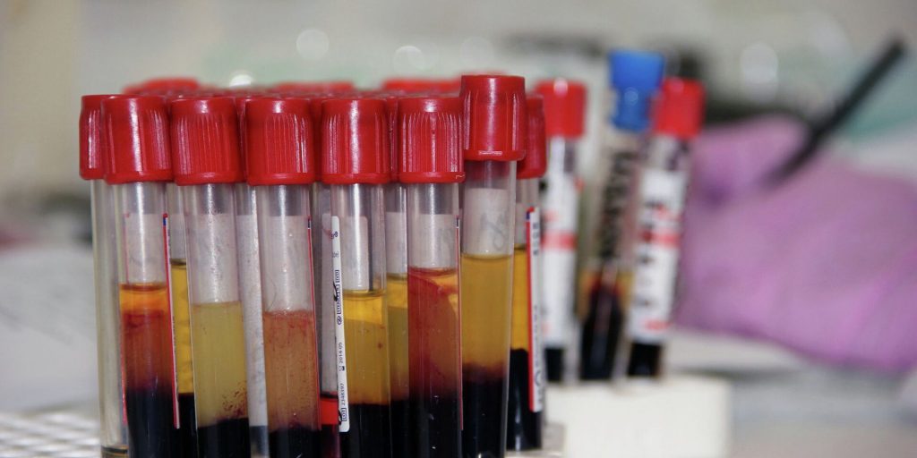 На риск развития инфаркта миокарда влияет группа крови