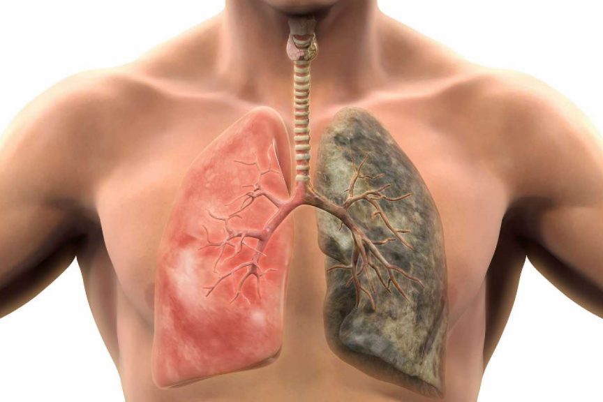 Бронхи и легкие: лучшие народные рецепты очищения