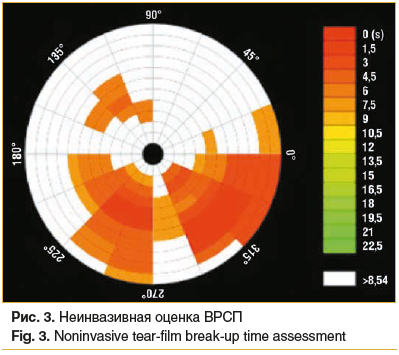Рис. 3. Неинвазивная оценка ВРСП Fig. 3. Noninvasive tear-film break-up time assessment