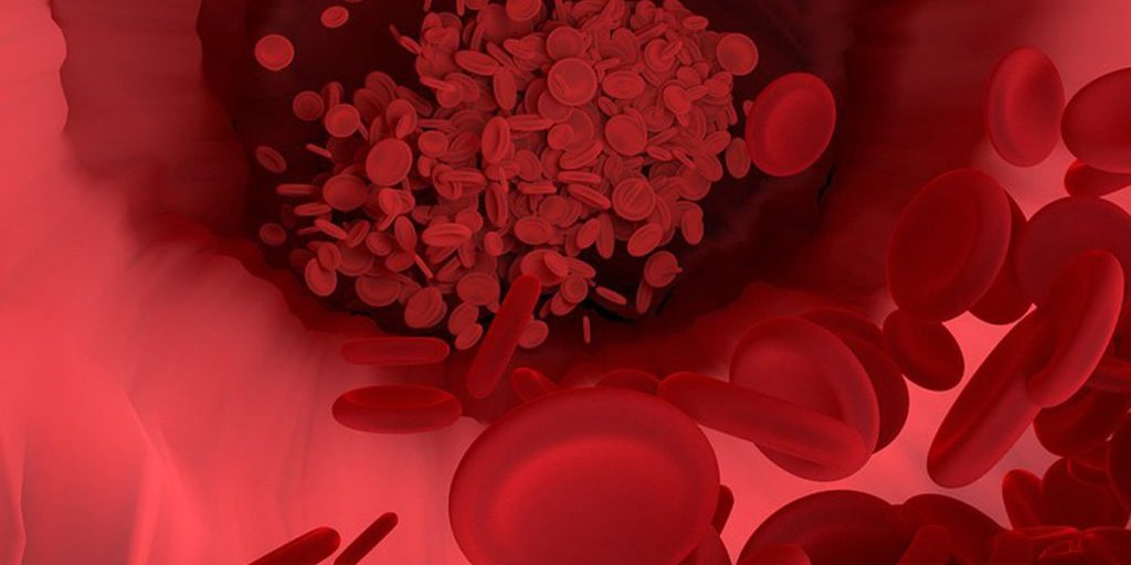 Как можно почистить сосуды на самом деле