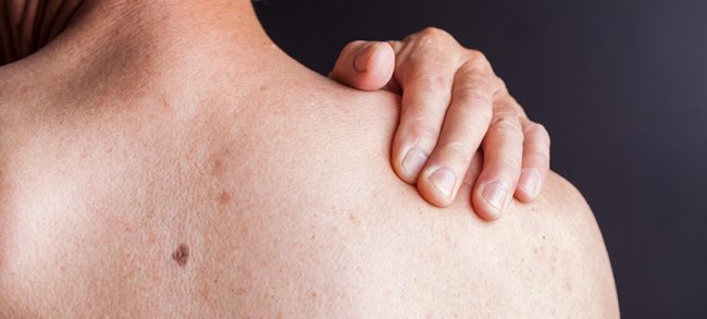 Стало известно, как людям с псориазом ухаживать за кожей весной