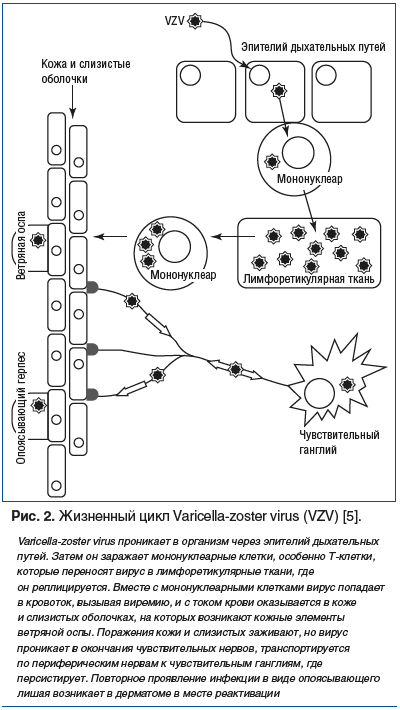 Рис. 2. Жизненный цикл Varicella-zoster virus (VZV) [5]. Varicella-zoster virus проникает в организм через эпителий дыхательных путей. Затем он заражает мононуклеарные клетки, особенно Т-клетки, которые переносят вирус в лимфоретикулярные ткани, где он ре