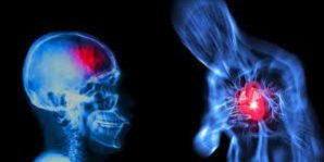 ИНФАРКТ И ИНСУЛЬТ: главное, успеть вовремя!