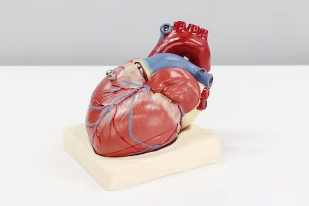 Кардиолог Кузнецов рассказал, что позволяет узнать нетипичный инфаркт