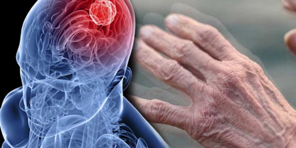 Академик Иллариошкин назвал ночной симптом, который предупредит о болезни Паркинсона