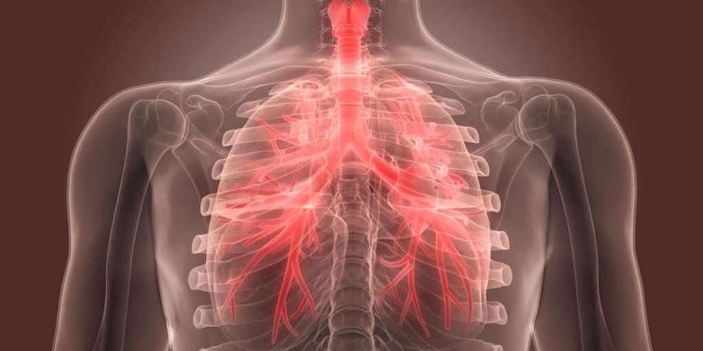 Бронхит: симптомы, причины, лечение — Медицина 2.0