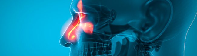 В портфеле «Петровакс Фарм» появился препарат Демефецил для комплексной терапии