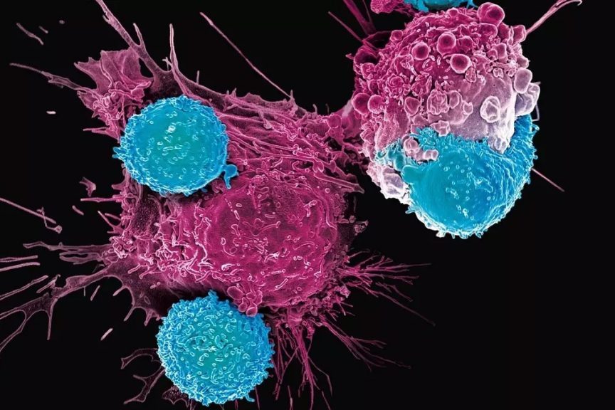Исследование показывает, как рак может перехватить полезный иммунный путь распространения