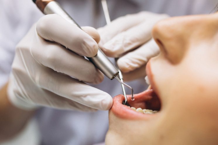 Стоматолог Касем перечислил самые вредные для зубов продукты