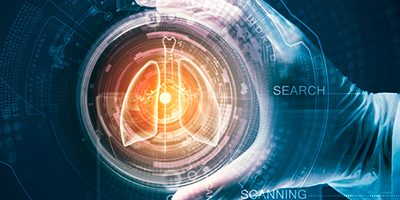 «АстраЗенека» представила новые данные в области инновационной терапии рака легкого