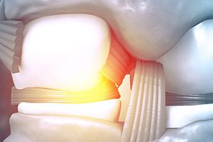 Резидент «Сколково» представил бионический протез нового поколения