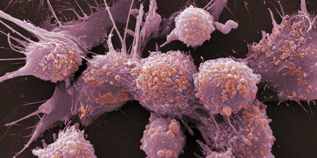 Ученые МФТИ выяснили, что раковая опухоль подчиняет себе соседние здоровые