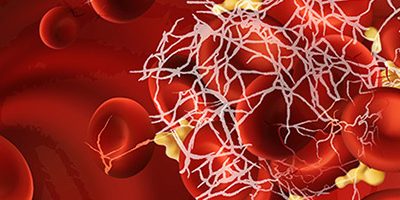 В 35-й раз в мире отмечается День гемофилии