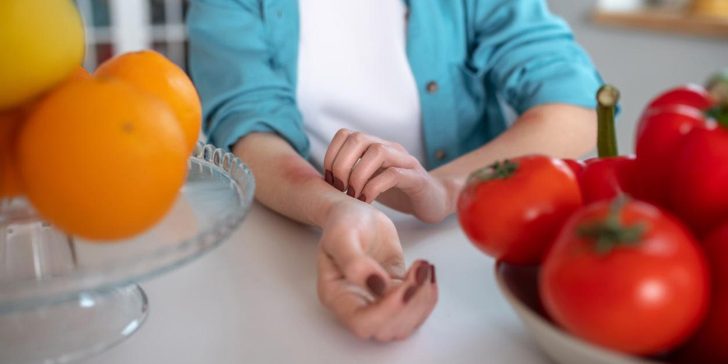 Весна без сюрпризов. Какое исследование пригодится аллергикам и сидящим на