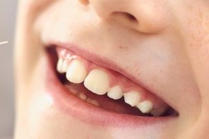 Специалисты ПИМУ Минздрава России разработали новую методику ранней диагностики кариеса