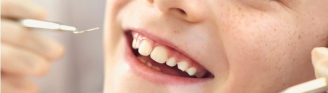 Специалисты ПИМУ Минздрава России разработали новую методику ранней диагностики кариеса