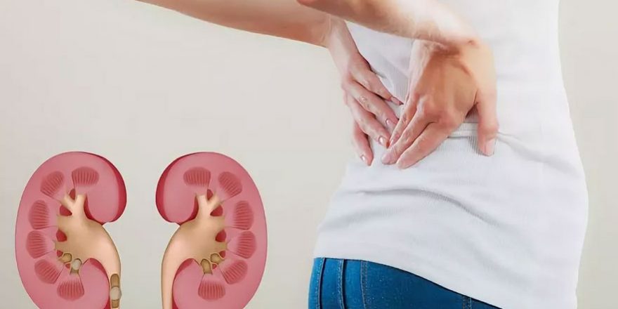 Очищение почек по Маловичко — Медицина 2.0