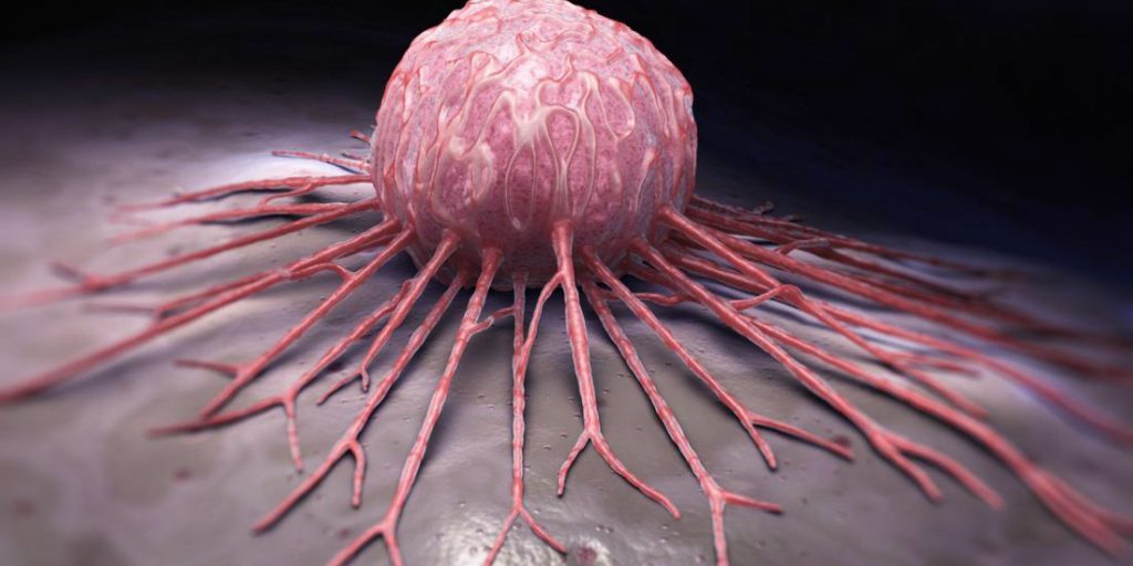 Анализ походки помогает в ранней диагностике нейродегенеративных заболеваний