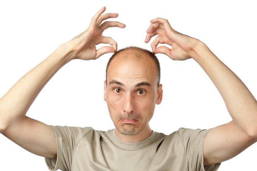 Ученые случайно обнаружили, что может вызывать облысение