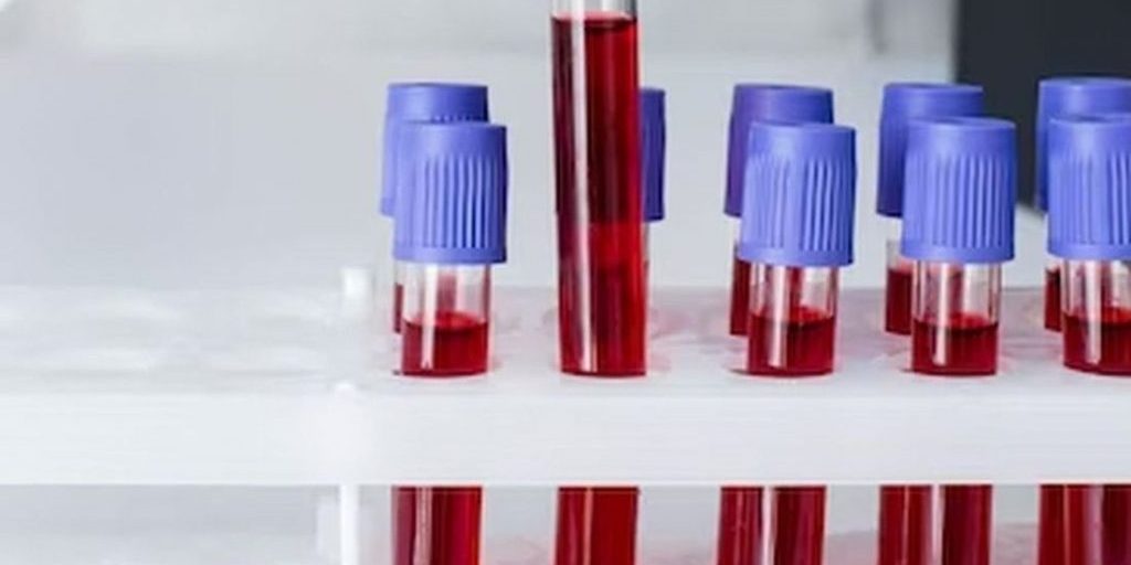 «Частая причина – обезвоживание»: врач Демьяновская назвала признаки сгущения крови