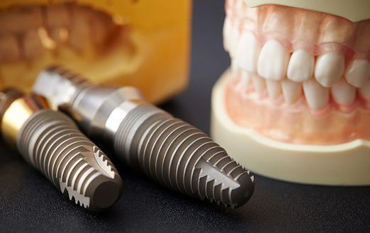 Современные методы укрепления зубов: от силиконовых кап до герметиков