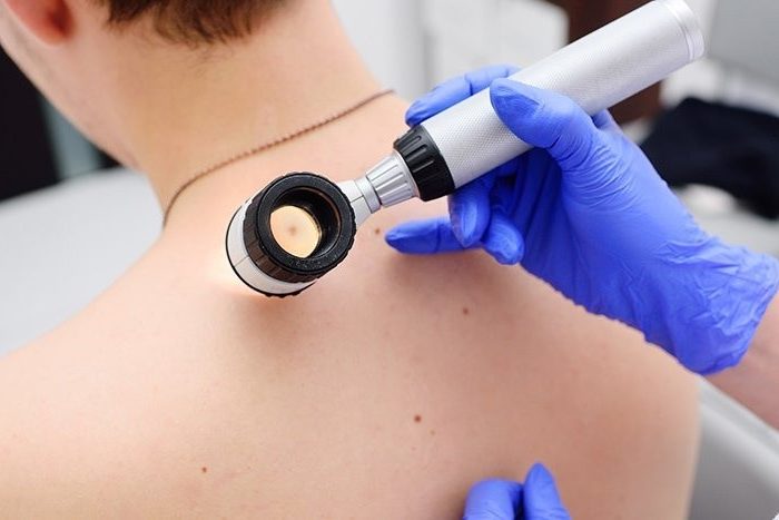 Врач рассказал о питании при кожных заболеваниях