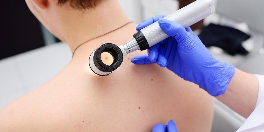 Врач рассказал о питании при кожных заболеваниях