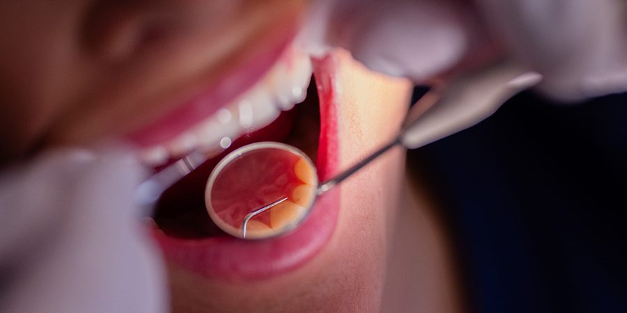 Стоматолог назвал богатые кальцием продукты, вызывающие кариес у детей