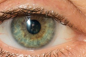 Одобрено новое показание фарицимаба для лечения макулярного отека вследствие окклюзии вен