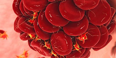 Генетики рассказали, у каких народов выше риск тромбоза