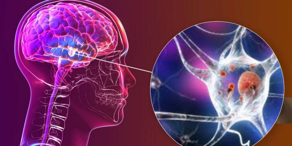 Новый метод выявляет болезнь Паркинсона по эмоциональным реакциям мозга