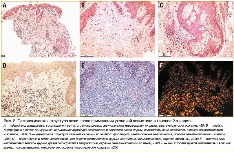 Рис. 2. Гистологическая структура кожи после применения уходовой косметики в течение 2-х недель.