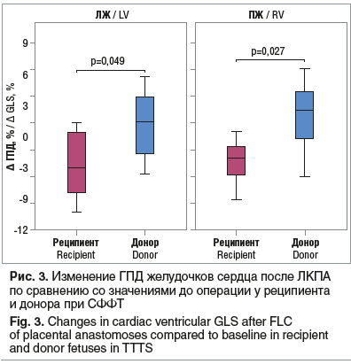 Рис. 3. Изменение ГПД желудочков сердца после ЛКПА по сравнению со значениями до операции у реципиента и донора при СФФТ Fig. 3. Changes in cardiac ventricular GLS after FLC of placental anastomoses compared to baseline in recipient and donor fetuses in T